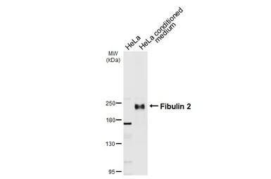 Anti-Fibulin 2 antibody used in Western Blot (WB). GTX105108