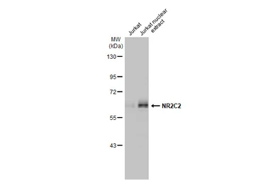 Anti-NR2C2 antibody used in Western Blot (WB). GTX105119