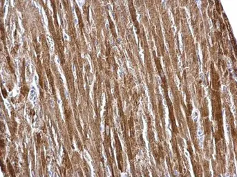 Anti-ETFA antibody used in IHC (Paraffin sections) (IHC-P). GTX105155