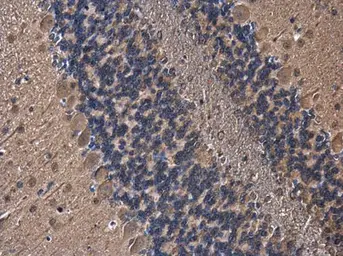 Anti-PLCL1 antibody used in IHC (Paraffin sections) (IHC-P). GTX105168