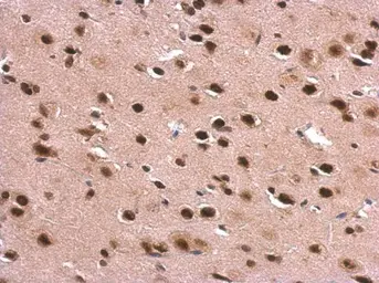 Anti-DDX1 antibody [N3C2], Internal used in IHC (Paraffin sections) (IHC-P). GTX105205