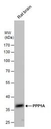 Anti-PPP1A antibody used in Western Blot (WB). GTX105255