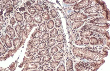 Anti-PPP1A antibody used in IHC (Paraffin sections) (IHC-P). GTX105255