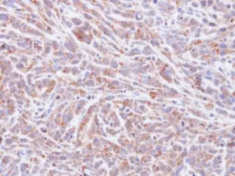 Anti-PPP1A antibody used in IHC (Paraffin sections) (IHC-P). GTX105255