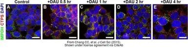 Anti-CTP synthase antibody [N1C1] used in Immunocytochemistry/ Immunofluorescence (ICC/IF). GTX105265