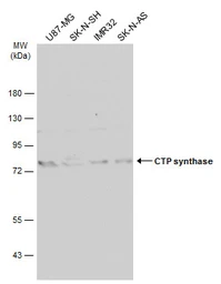 Anti-CTP synthase antibody [N1C1] used in Western Blot (WB). GTX105265