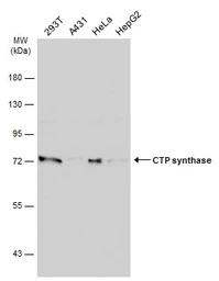 Anti-CTP synthase antibody [N1C1] used in Western Blot (WB). GTX105265