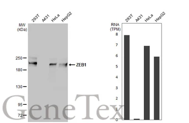 Anti-ZEB1 antibody [N2C1], Internal used in Western Blot (WB). GTX105278