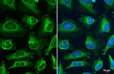 Anti-FDPS antibody [N1C3] used in Immunocytochemistry/ Immunofluorescence (ICC/IF). GTX105301