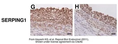 Anti-C1 inhibitor antibody [N1C3] used in IHC (Paraffin sections) (IHC-P). GTX105316