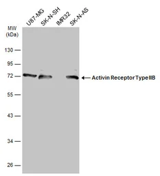 Anti-Activin Receptor Type IIB antibody [N1C1] used in Western Blot (WB). GTX105330