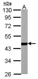 Anti-PSMC5 antibody used in Western Blot (WB). GTX105347