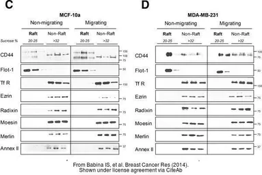 Anti-Radixin antibody used in Western Blot (WB). GTX105408