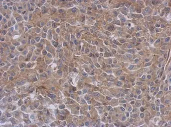 Anti-Radixin antibody used in IHC (Paraffin sections) (IHC-P). GTX105408