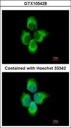 Anti-MMP8 antibody used in Immunocytochemistry/ Immunofluorescence (ICC/IF). GTX105428