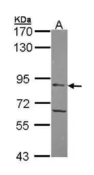 Anti-APEH antibody used in Western Blot (WB). GTX105450