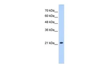 Anti-SLC25A14 antibody, N-term used in Western Blot (WB). GTX10554