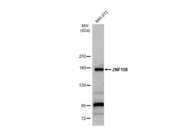 Anti-ZNF198 antibody used in Western Blot (WB). GTX105550