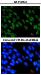 Anti-ZNF198 antibody used in Immunocytochemistry/ Immunofluorescence (ICC/IF). GTX105550