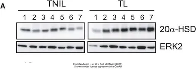 Anti-AKR1C1 antibody used in Western Blot (WB). GTX105620