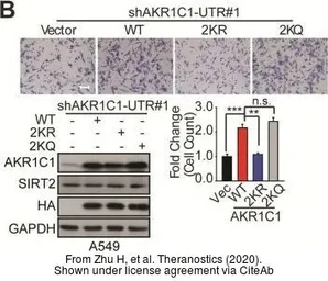 Anti-AKR1C1 antibody used in Western Blot (WB). GTX105620