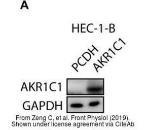 Anti-AKR1C1 antibody used in Western Blot (WB). GTX105620