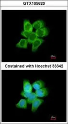 Anti-AKR1C1 antibody used in Immunocytochemistry/ Immunofluorescence (ICC/IF). GTX105620
