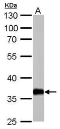 Anti-AKR1C1 antibody used in Western Blot (WB). GTX105620