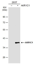 Anti-AKR1C1 antibody used in Western Blot (WB). GTX105620