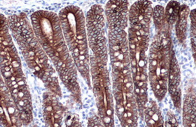Anti-Cytokeratin 18 antibody [N2C2], Internal used in IHC (Paraffin sections) (IHC-P). GTX105624
