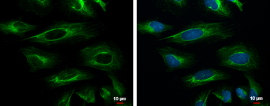 Anti-Cytokeratin 18 antibody [N2C2], Internal used in Immunocytochemistry/ Immunofluorescence (ICC/IF). GTX105624