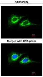 Anti-Cytokeratin 18 antibody [N2C2], Internal used in Immunocytochemistry/ Immunofluorescence (ICC/IF). GTX105624
