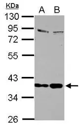 Anti-Selenoprotein P antibody used in Western Blot (WB). GTX105647