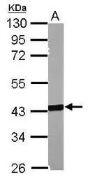 Anti-MSL3L1 antibody used in Western Blot (WB). GTX105652