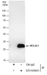 Anti-Bcl-X antibody used in Immunoprecipitation (IP). GTX105661
