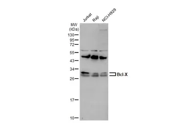 Anti-Bcl-X antibody used in Western Blot (WB). GTX105661