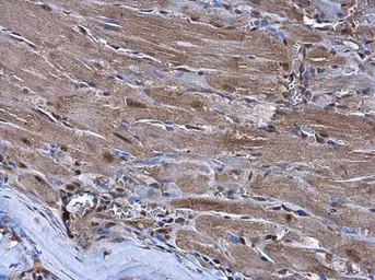 Anti-Nkx2.5 antibody used in IHC (Paraffin sections) (IHC-P). GTX105711