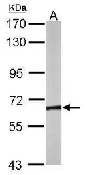 Anti-TCP1 theta antibody [N2C2], Internal used in Western Blot (WB). GTX105725