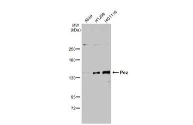 Anti-Pez antibody [C2C3], C-term used in Western Blot (WB). GTX105769