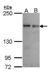 Anti-SEC31A antibody [N1N3] used in Western Blot (WB). GTX105784