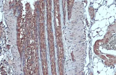 Anti-IL13 Receptor alpha 1 antibody used in IHC (Paraffin sections) (IHC-P). GTX105788
