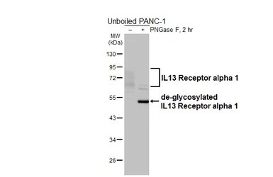 Anti-IL13 Receptor alpha 1 antibody used in Western Blot (WB). GTX105788