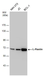 Anti-L-Plastin antibody used in Western Blot (WB). GTX105789