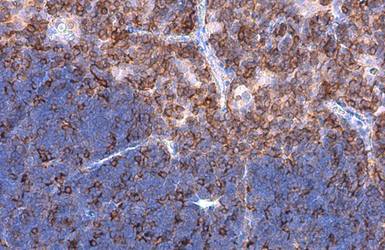 Anti-L-Plastin antibody used in IHC (Paraffin sections) (IHC-P). GTX105789