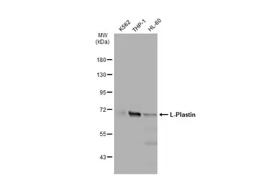 Anti-L-Plastin antibody used in Western Blot (WB). GTX105789
