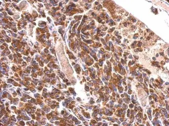 Anti-MDH2 antibody used in IHC (Paraffin sections) (IHC-P). GTX105870