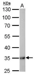 Anti-MDH2 antibody used in Western Blot (WB). GTX105870