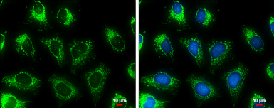 Anti-MDH2 antibody used in Immunocytochemistry/ Immunofluorescence (ICC/IF). GTX105870