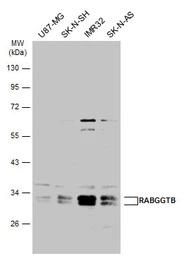 Anti-RABGGTB antibody used in Western Blot (WB). GTX105874