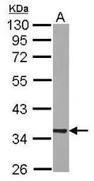 Anti-RABGGTB antibody used in Western Blot (WB). GTX105874